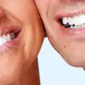 Как да се предпазим от образуването на зъбен камък?