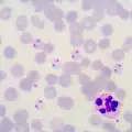Малария