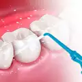 Ползите от употреба на зъбен душ