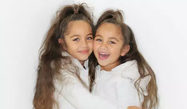 Светът пощуря по красотата на тези близначки