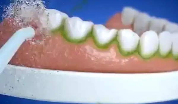 Зъбен душ
