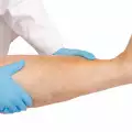 Подуване на краката при диабет