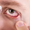 Увреждане на зрението