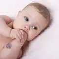 Хемангиом