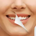Как да имаме по-бели зъби и ослепителна усмивка