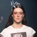 Моделът с различна кожа ще ви научи да обичате себе си