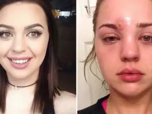 Опасна бактерия, пренесена от четка за грим, едва не уби младо момиче