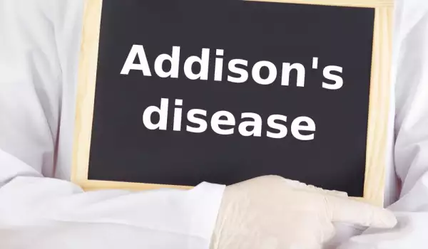 Болест на Адисон