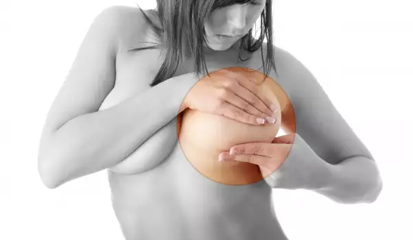Затлъстяването води до рак на гърдата