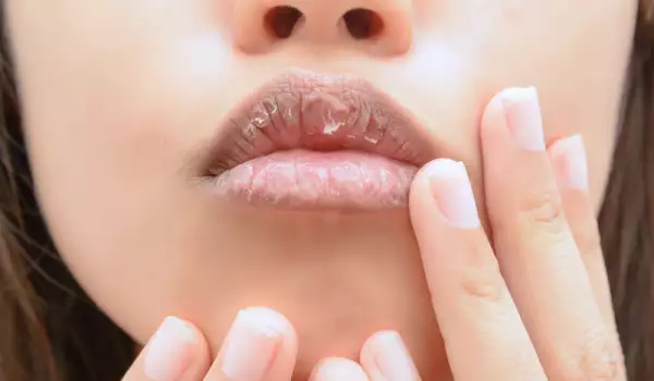 Как да ексфолираме напуканите устни през зимата