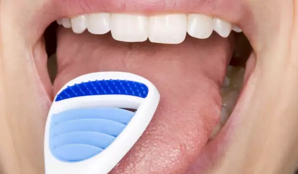 Как да премахнем белите налепи по езика?