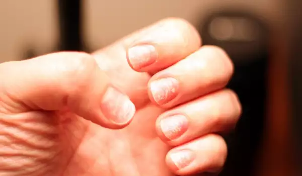 Как да предпазим ноктите от чупене и делене?