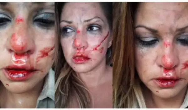 Кървав ужас! Българска певица е била пребита от приятеля си швед