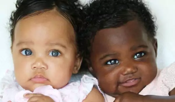 Тези близнаци са родени с различен цвят на кожата, но са тотално идентични