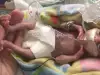 Тя е най-недоносеното бебе и не ѝ даваха шанс за живот
