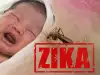 Вирусът Зика причинява Алцхаймер